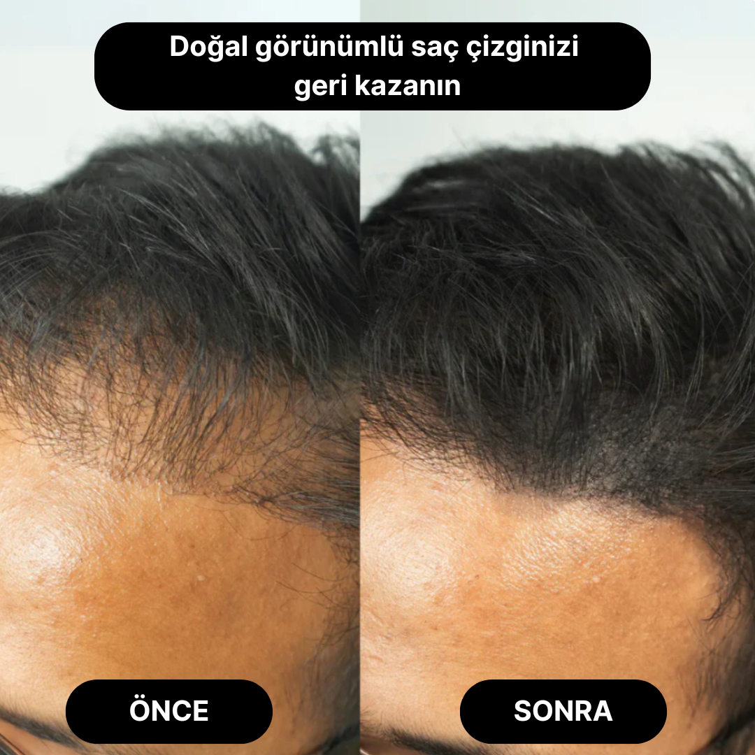 Rootify® Saç Tozu
