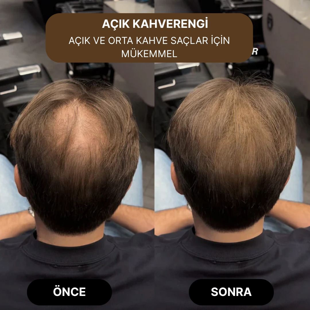 Rootify® Saç Tozu